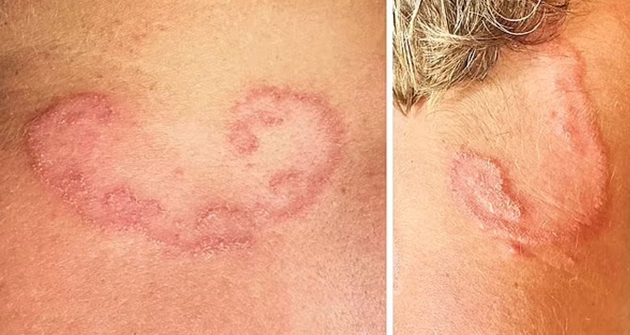 Döküntü sandığı izler parazit çıktı: Sebebi günlük bir aktivite